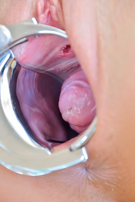 Brunette shows her pussy after fisting, using her favorite speculum